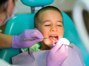 Teeth Cleaning and Checkups for Children - Smile center for Kids El Paso TX